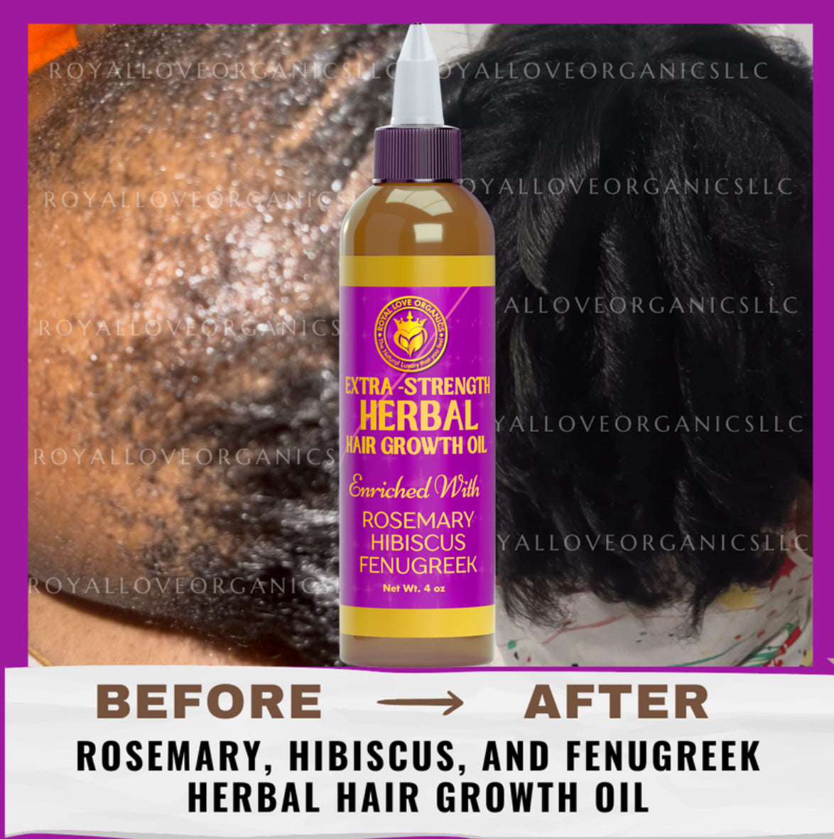 Rosemary hair growth oil