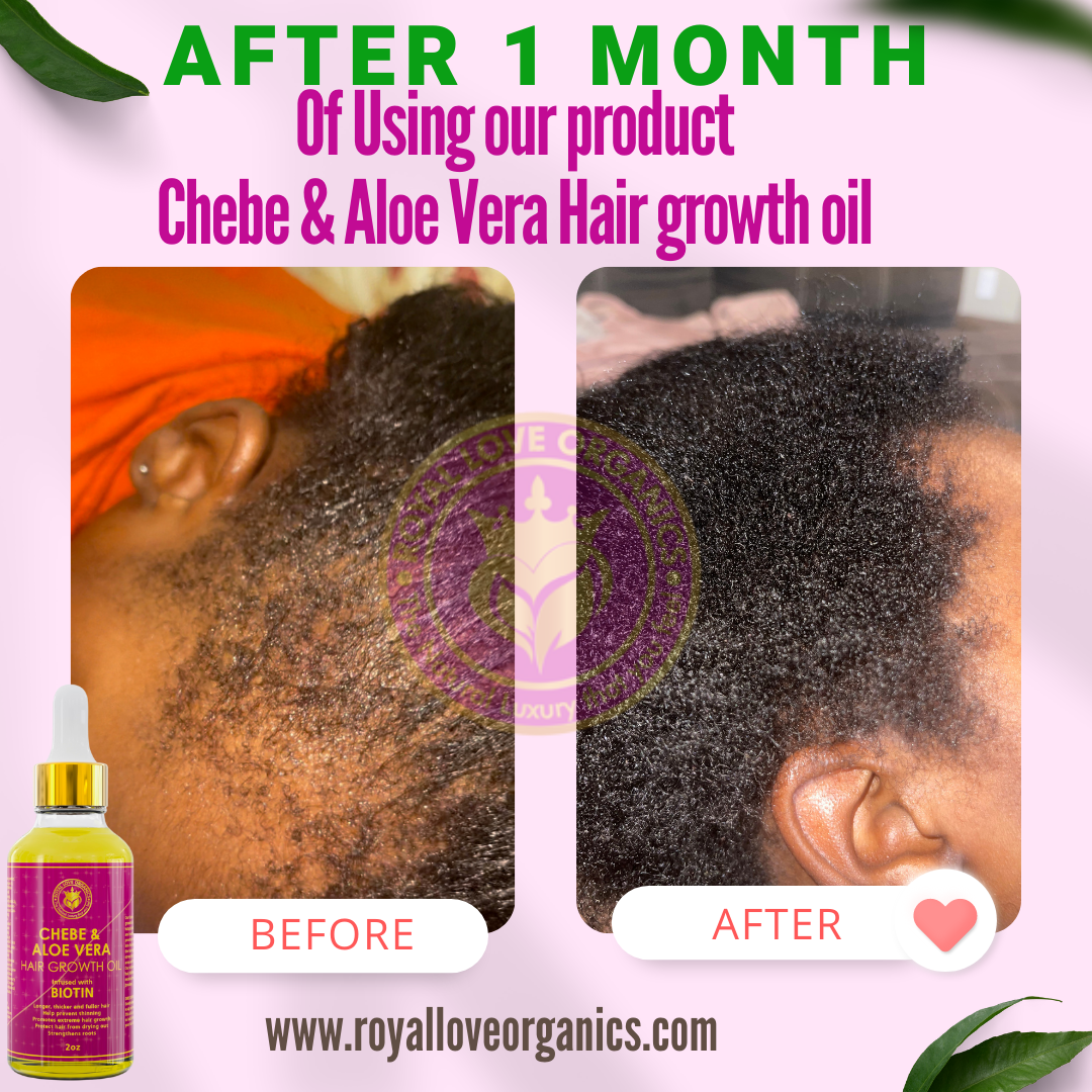 Cheb Hair Oil -Results